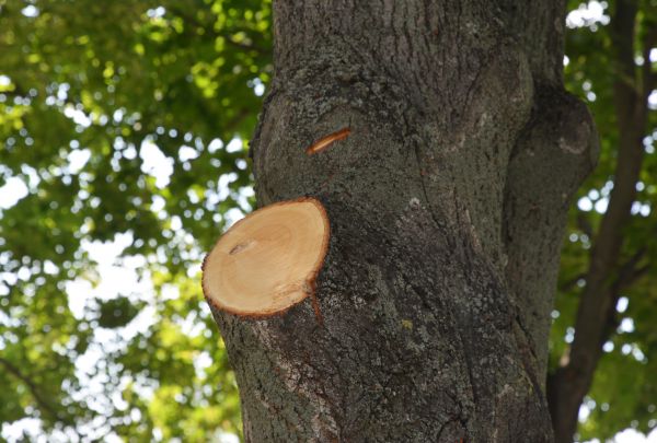 Cost of Limb Cutting in Battle Creek